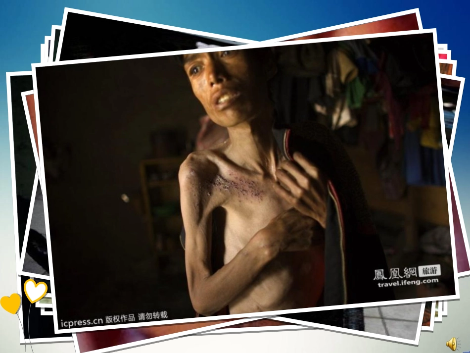 《生命的药方》PPT课件[湘教版四年级语文上册]_第3页