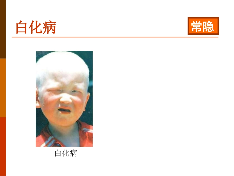 《遗传病和优生优育》PPT课件[苏教版八年级生物下册]_第3页
