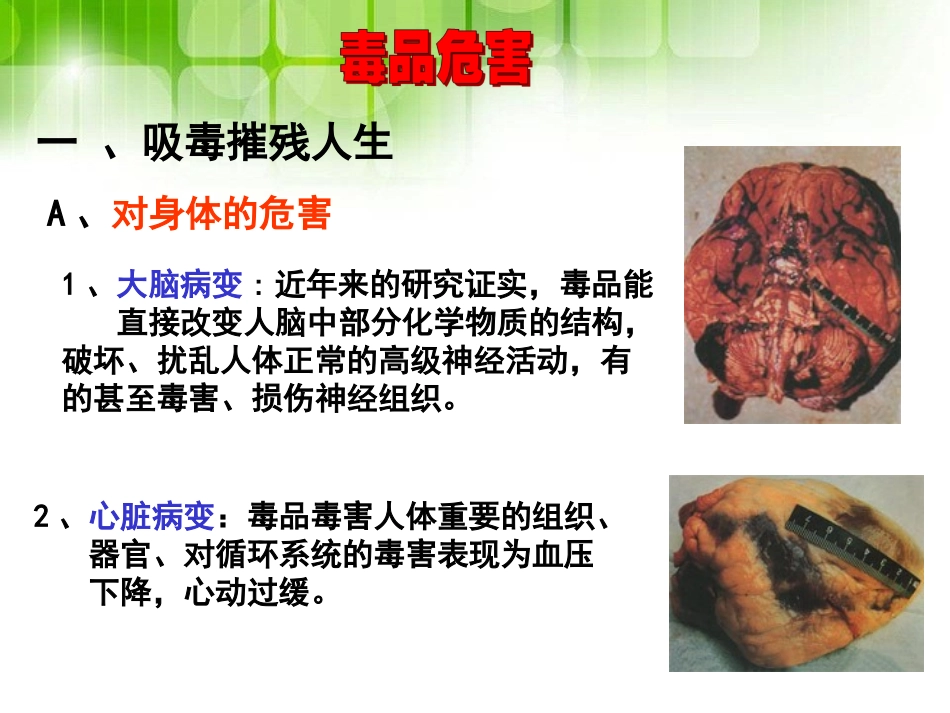 《珍爱生命 远离毒品》PPT课件[健康主题班会PPT]_第2页