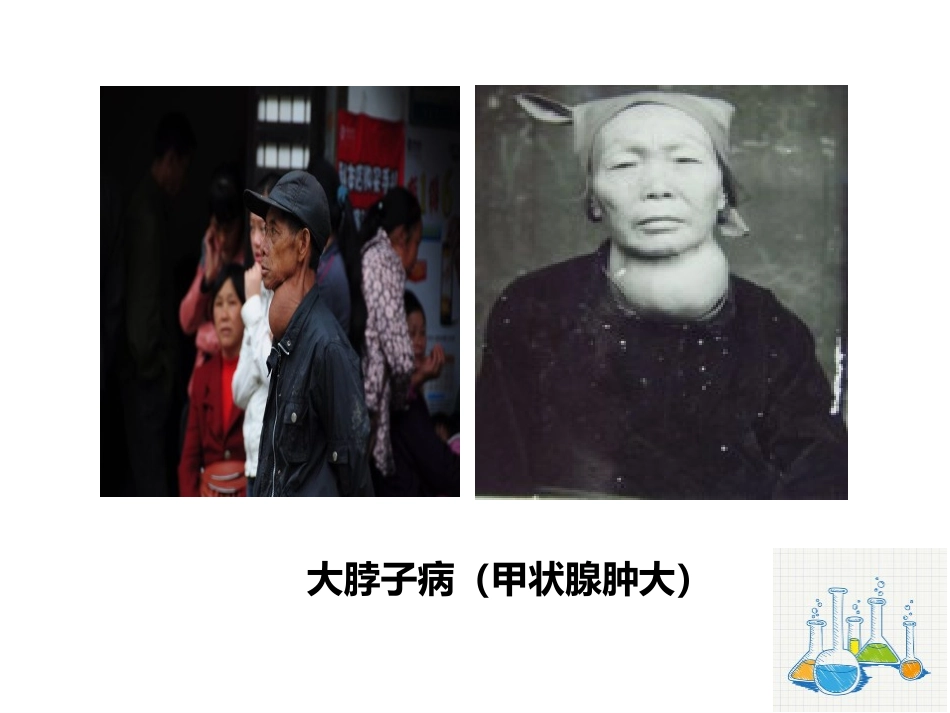 《化学元素与人体健康》PPT教学课件[人教版九年级化学下册]_第2页