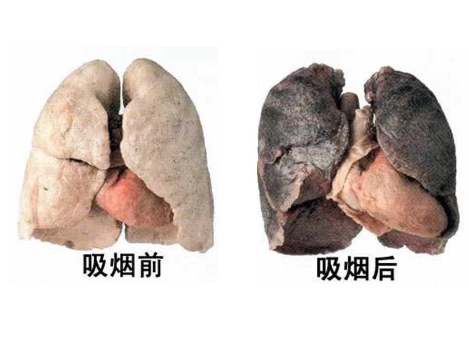 《远离烟酒》PPT课件[苏教版八年级生物下册]_第2页